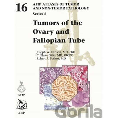 Tumors of the Ovary and Fallopian Tube - C. Blake Gilks