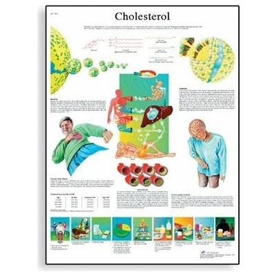 Schéma - cholesterol - AJ - 50x67 cm Papier s lištou