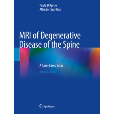 MRI of Degenerative Disease of the Spine