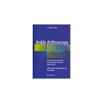 Image 1 of Ankle Arthroscopy | Niek van Dijk