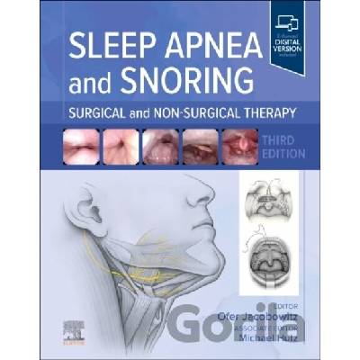 Sleep Apnea and Snoring - Ofer, MD, PhD, FAASM, FAAOA Jacobowitz