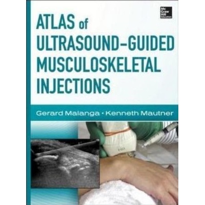 Atlas of Ultrasound-Guided Musculoskeletal Injections - Malanga Gerard