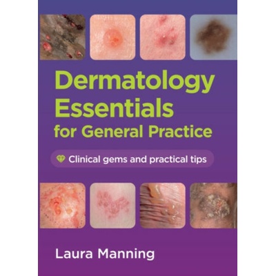Dermatology Essentials for General Practice - Laura Manning