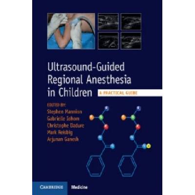 Ultrasound-Guided Regional Anesthesia in Children | Stephen Mannion, Gabrielle Iohom, Christophe Dadure, Mark Reisbig