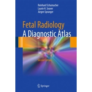 Fetal Radiology | Reinhard Schumacher, Laurie H. Seaver, Jurgen Spranger (ISBN: 9783642440137)