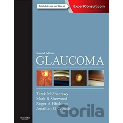 Glaucoma, 2nd Edition, 2-Volume Set