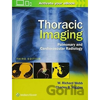 Thoracic Imaging Webb W.Richard