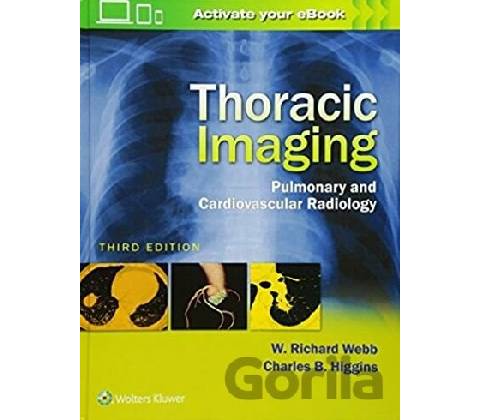 Thoracic Imaging Webb W.Richard
