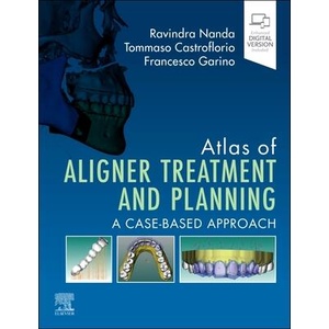Atlas of Aligner Treatment and Planning (ISBN: 9780443116087)