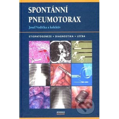 Spontánní pneumotorax - Josef Vodička a kolektív