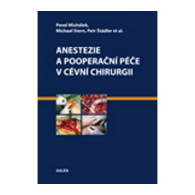 Anestezie a pooperační péče v cévní chirurgii - Petr Štádler, Pavel Michálek, Michael Stern