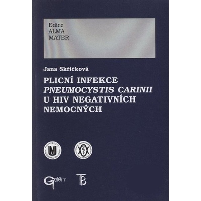 Plicní infekce Pneumocystis carinii u HIV negativních nemocných -