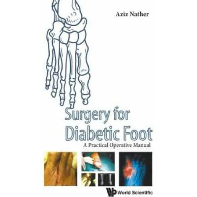 Surgery For Diabetic Foot: A Practical Operative Manual | Nather Abdul Aziz