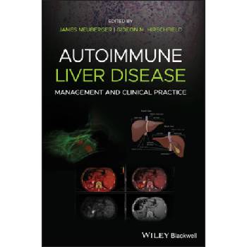 Autoimmune Liver Disease - Management and Clinical Practice