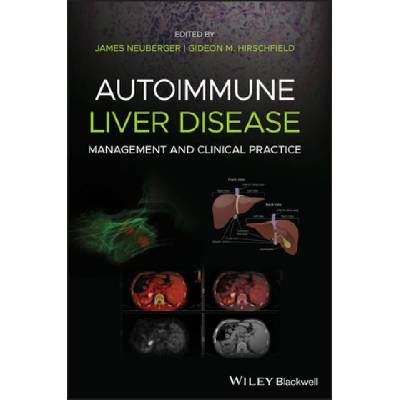 Autoimmune Liver Disease - Management and Clinical Practice