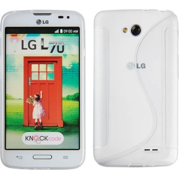 Image 1 of LG Силиконов калъф за LG L70 (SKLGL70White)