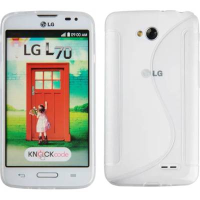 LG Силиконов калъф за LG L70 (SKLGL70White)