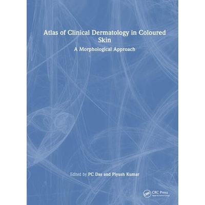 Atlas of Clinical Dermatology in Coloured Skin Taylor & Francis Ltd