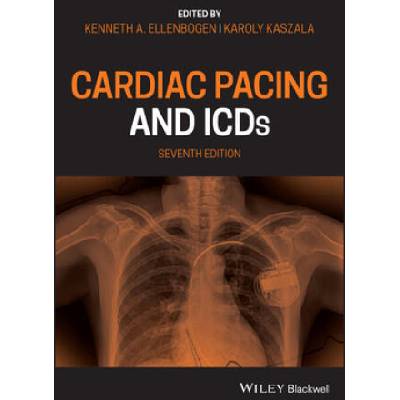Cardiac Pacing and ICDs 7e