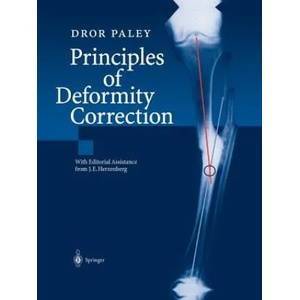 Principles of Deformity Correction | Dror Paley, J. E. Herzenberg (2014)