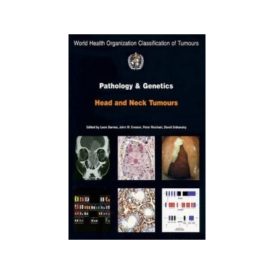Pathology and Genetics of Head and Neck Tumours IARC WHO Classification of Tumours - L. Barnes