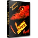 king kobra DVD