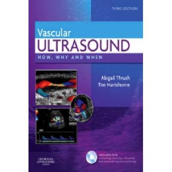 Vascular Ultrasound | Abigail Thrush