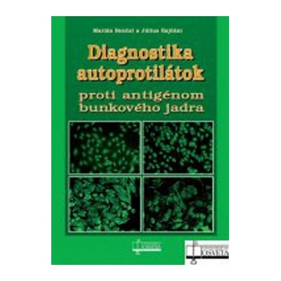 Diagnostika autoprotilátok proti antigénom bunkového jadra - Rajčáni Július, Benčat Marián