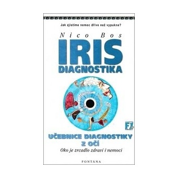 Iris diagnostika