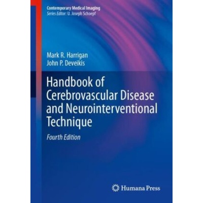 Handbook of Cerebrovascular Disease and Neurointerventional Technique