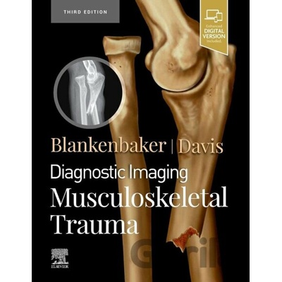 Diagnostic Imaging: Musculoskeletal Trauma - Donna G. Blankenbaker, Kirkland W. Davis