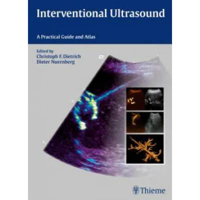 Interventional Ultrasound | Christoph Frank Dietrich, Dieter Nürnberg, Christoph Frank Dietrich