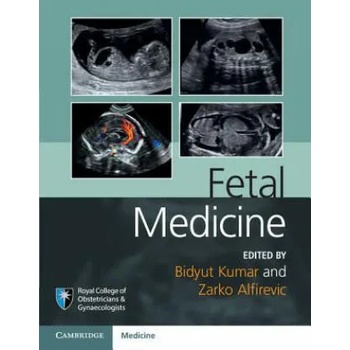 Image 1 of Fetal Medicine | Bid Kumar, Zarko Alfirevic