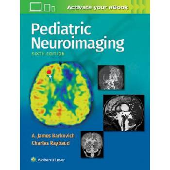 Pediatric Neuroimaging | Barkovich, A. James, MD, Charles Raybaud