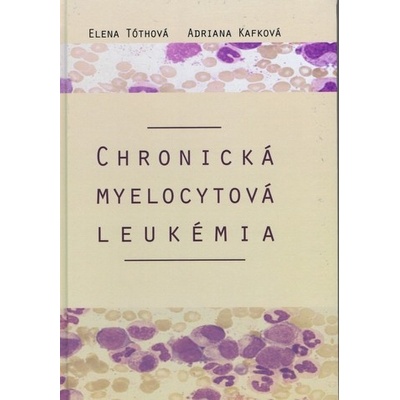Chronická myelocytová leukémia - Elena Tóthová