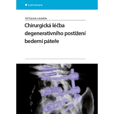 Chirurgická léčba degenerativního postižení bederní páteře - Jiří a kolektiv Šrám
