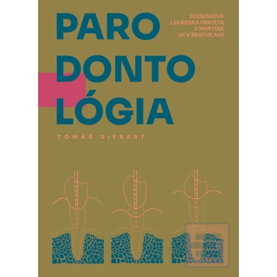 Parodontológia - Doc. MUDR. Tomáš Siebert, PhD