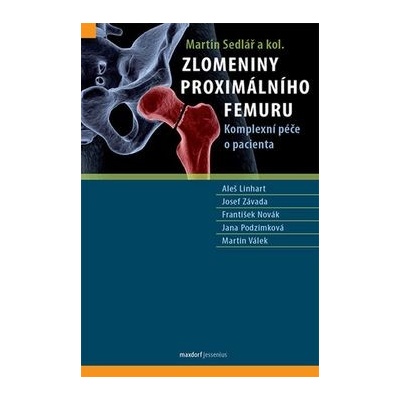 Zlomeniny proximálního femuru - Martin Sedlář