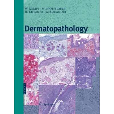 Dermatopathology | Walter H. C. Burgdorf, Markus Hantschke, Werner Kempf, Heinz Kutzner