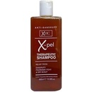 Šampony Xpel Therapeutic Anti-Dandruff Shampoo 300 ml