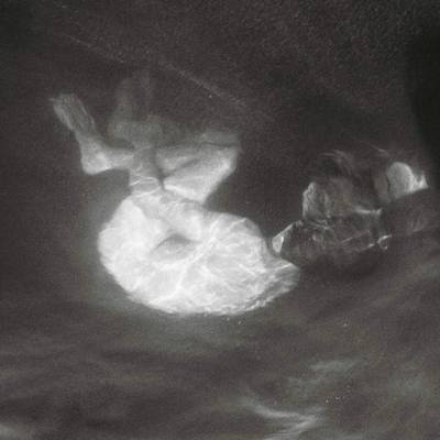 PHOEBE LOU, ALICE - GLOW CD