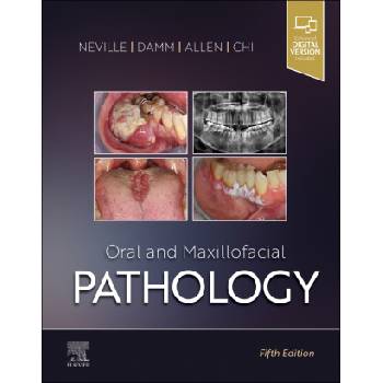Oral and Maxillofacial Pathology | Brad W. Neville, Douglas D. Damm, Carl M. Allen, Angela C. Chi