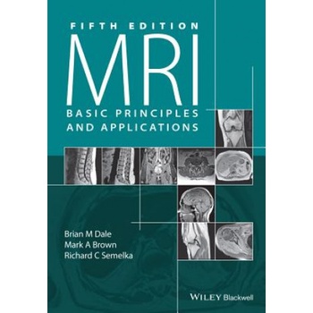 MRI Basic Principles and Applications, 5e