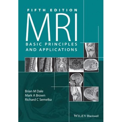 MRI Basic Principles and Applications, 5e | Brian M. Dale, Mark A. Brown, Richard C. Semelka