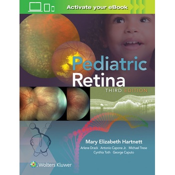 Pediatric Retina
