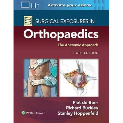 Surgical Exposures in Orthopaedics: The Anatomic Approach | de Boer, Piet, Buckley, Richard, Hoppenfeld, Stanley