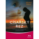 Císařský řez