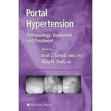 Portal Hypertension: Pathobiology, Evaluation, and Treatment (Sanyal Arun J.)