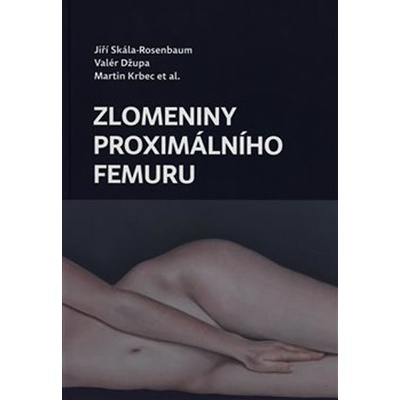 Zlomeniny proximálního femuru - Krbec Martin, Skála-Rosenbaum Jiří, Džupa Valér