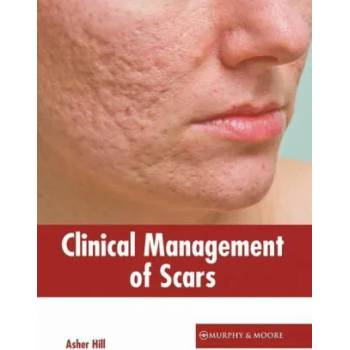 Image 1 of Clinical Management of Scars | Asher Hill